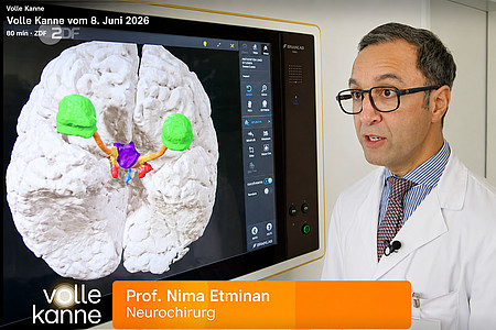 Professor Etminan erläutert vor einer 3-D-Darstellung eines Schädelbasistumors, welche besonderen Herausforderung bei einer OP bestehen.